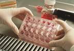 USPSTF: Screen high-risk groups for HBV USPSTF: Screen high-risk groups for HBV