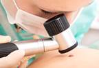 Presence, pain intensity, itch may be signs of skin cancer Presence, pain intensity, itch may be signs of skin cancer