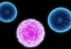 What does persistent polyclonal B-cell lymphocytosis look like? What does persistent polyclonal B-cell lymphocytosis look like?