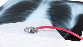 CVD risks hit blacks, females harder CVD risks hit blacks, females harder