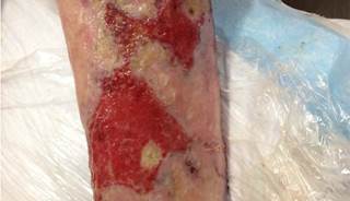 September 2014 Dermatology CME/CE September 2014 Dermatology CME/CE