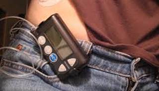 Insulin pumps decrease mortality, cardiovascular disease risk Insulin pumps decrease mortality, cardiovascular disease risk