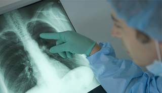 A clinician reviews a patient's lung scan A clinician reviews a patient's lung scan