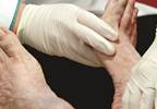 Statins cut microvascular risk in diabetes Statins cut microvascular risk in diabetes