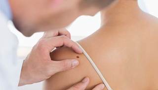 Cancer rates higher in psoriasis patients Cancer rates higher in psoriasis patients
