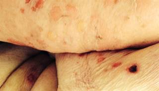 2014 November Dermatology Look-Alikes 2014 November Dermatology Look-Alikes