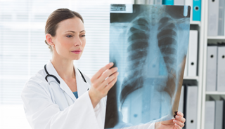 Medicare coverage of lung cancer screenings Medicare coverage of lung cancer screenings