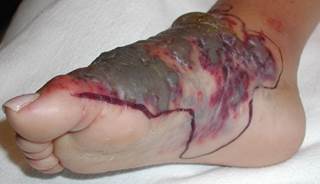 December 2014 Dermatology CME/CE December 2014 Dermatology CME/CE