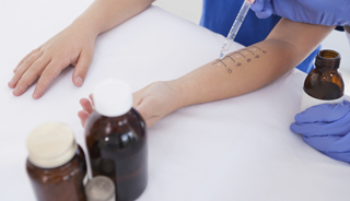 Profilins may induce severe food-allergic reactions Profilins may induce severe food-allergic reactions