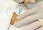 Intensive weight management, bariatric surgery yield similar results in type 2 diabetes Intensive weight management, bariatric surgery yield similar results in type 2 diabetes