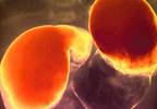 When abdominal pain is not appendicitis When abdominal pain is not appendicitis