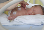 First neonatal SCID screening test approved by FDA First neonatal SCID screening test approved by FDA