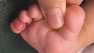 February 2015 Dermatology CME/CE February 2015 Dermatology CME/CE