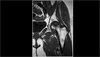 Risk Factor for Osteonecrosis in Patients With SLE Risk Factor for Osteonecrosis in Patients With SLE