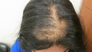 March 2015 Dermatology CME/CE March 2015 Dermatology CME/CE
