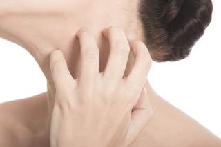 Eczema major U.S. health, cost burden Eczema major U.S. health, cost burden