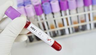 Increasing hepatitis B prevention could significantly reduce global mortality. Increasing hepatitis B prevention could significantly reduce global mortality.