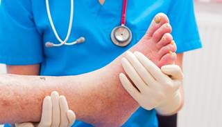 Almost 75% of cellulitis cases were misdiagnosed in the study. Almost 75% of cellulitis cases were misdiagnosed in the study.
