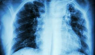The panel strongly discourages the use of anticoagulants. The panel strongly discourages the use of anticoagulants.