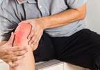 Total Knee Replacement Procedures Up From 2000 to 2010 Total Knee Replacement Procedures Up From 2000 to 2010