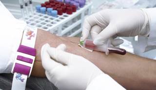 Most cases of hepatitis C are not reported to the CDC. Most cases of hepatitis C are not reported to the CDC.