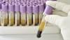 Factors Influencing Plasma Ropivacaine Concentrations After Local Infiltration Analgesia Factors Influencing Plasma Ropivacaine Concentrations After Local Infiltration Analgesia