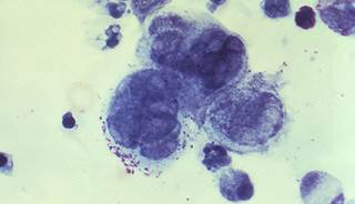 Tenofovir gel may reduce the risk of contracting herpes. Image courtesy of the CDC. Tenofovir gel may reduce the risk of contracting herpes. Image courtesy of the CDC.