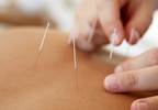 Acupuncture vs Sham Laser For Psychophysical Response: Is One Better Than the Other? Acupuncture vs Sham Laser For Psychophysical Response: Is One Better Than the Other?