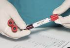 Early ART lowers risk of HIV-1 infection among sexual partners Early ART lowers risk of HIV-1 infection among sexual partners