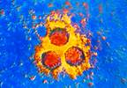 Herpes zoster subunit vaccine efficacy in immunocompetent adults ≥50 years old Herpes zoster subunit vaccine efficacy in immunocompetent adults ≥50 years old
