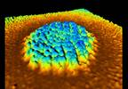 Human papillomavirus vaccination not linked to increase in sexually transmitted infections in adolescent females Human papillomavirus vaccination not linked to increase in sexually transmitted infections in adolescent females