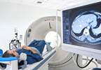Price Markup Associated With Outpatient Oncology Services Examined Price Markup Associated With Outpatient Oncology Services Examined