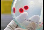 Reactive Arthritis Attributed to <i>E. Coli, Enterococcus Faecalis</i> GU Infection Reactive Arthritis Attributed to <i>E. Coli, Enterococcus Faecalis</i> GU Infection