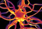 How to distinguish bradykinesia from psychomotor retardation How to distinguish bradykinesia from psychomotor retardation