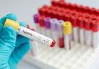 STD cases reach record high in the U.S. STD cases reach record high in the U.S.