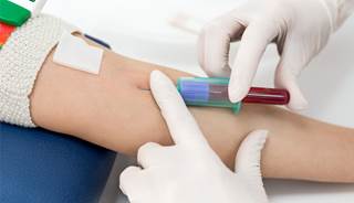 The American Academy of Pediatrics has called for all children to be regularly screened for high cholesterol, depression, and HIV. The American Academy of Pediatrics has called for all children to be regularly screened for high cholesterol, depression, and HIV.