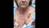 Derm Dx: Redness on a woman's face and torso Derm Dx: Redness on a woman's face and torso