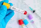 Diagnostic factors help patients avoid confirmatory prostate biopsy Diagnostic factors help patients avoid confirmatory prostate biopsy