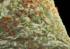 Initiating antiretroviral therapy in HIV patients with CD4 T-cell counts >500 cells/mcL Initiating antiretroviral therapy in HIV patients with CD4 T-cell counts >500 cells/mcL