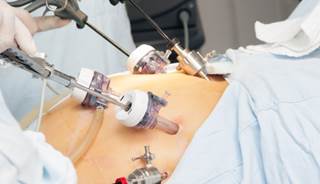 Although gastric bypass surgery improves patient well-being, they often experiences symptoms. Although gastric bypass surgery improves patient well-being, they often experiences symptoms.