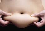 Rheumatoid arthritis disease activity improvement with bariatric surgery Rheumatoid arthritis disease activity improvement with bariatric surgery