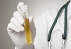 Hematuria evaluation guidelines issued by ACP Hematuria evaluation guidelines issued by ACP