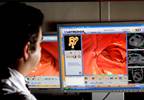 In patients with first unprovoked venous thromboembolism, adding CT to limited cancer screening may not lead to statistically higher rate of cancer detection In patients with first unprovoked venous thromboembolism, adding CT to limited cancer screening may not lead to statistically higher rate of cancer detection