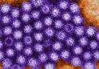 Stat Consult: Norovirus
infection Stat Consult: Norovirus
infection