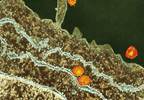 Signs and symptoms of hepatitis C virus infection Signs and symptoms of hepatitis C virus infection