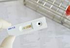 HIV testing rates low among young adults, teens, according to CDC report HIV testing rates low among young adults, teens, according to CDC report
