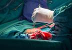 Coronary bypass surgery reduces mortality for patients with heart failure Coronary bypass surgery reduces mortality for patients with heart failure