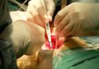 Patients with psoriasis have an increased risk of abdominal aortic aneurysm Patients with psoriasis have an increased risk of abdominal aortic aneurysm
