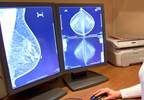 Digital mammography plus tomosynthesis linked to increased rate of breast cancer diagnosis Digital mammography plus tomosynthesis linked to increased rate of breast cancer diagnosis