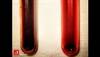 Image of the Week: Why is this pregnant woman's skin and blood discolored? Image of the Week: Why is this pregnant woman's skin and blood discolored?